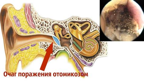 Болезнь уха: суть проблемы
