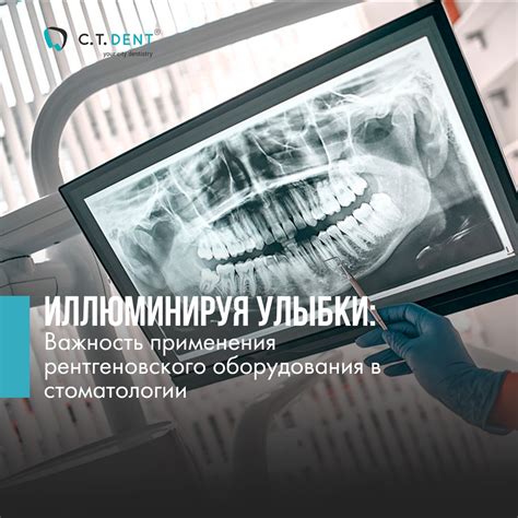 Важность применения одуванчиков в составе компоста