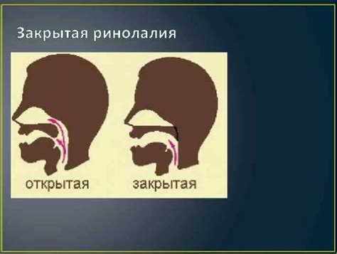 Влияние носовых полостей на речевое произношение