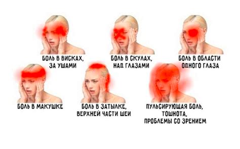 Головная боль: причины и типы