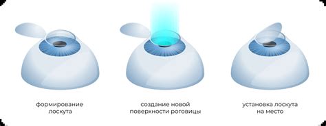 Коррекция зрения перед принятием на военную службу: подготовка к службе без недостатков зрения