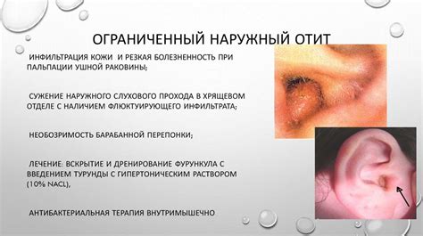 Основные признаки заболевания уха