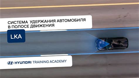 Преимущества и недостатки систем удержания автомобиля: сравнение brake holder
