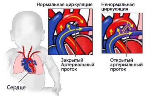 Причины возникновения неоперабельного порока сердца