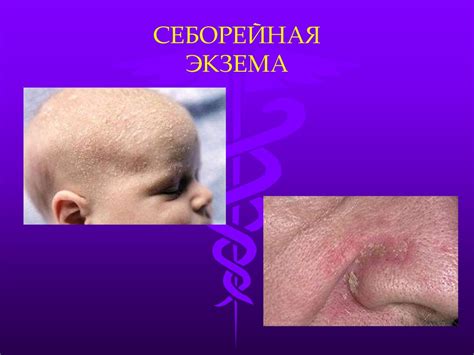Роль подкожного жирового слоя в области подбородка