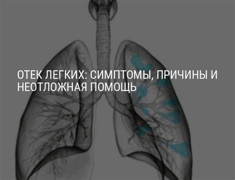 Симптомы, причины и последствия отека легких