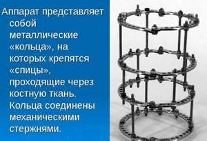 Технические особенности и параметры использования
