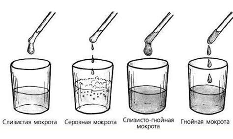 Факторы, вызывающие отхаркивание мокроты