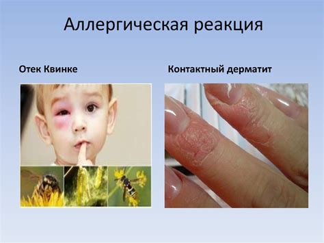 Аллергические реакции на хлеб и молоко у щенков