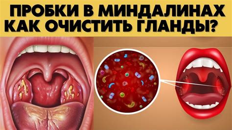 Важные моменты, которые следует учесть при применении холса при першении в горле