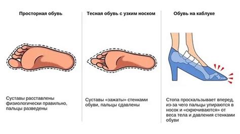 Влияние неправильной обуви и техники