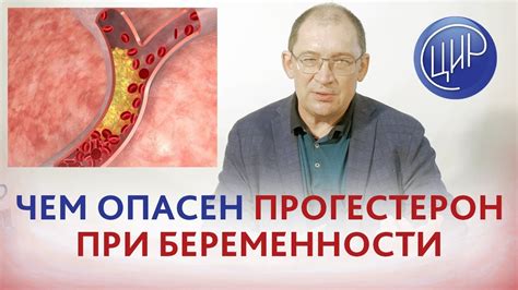 Влияние прогестерона на рост ХГЧ во время беременности