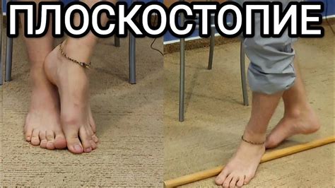 Возможности активной жизни при плоскостопии