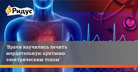 Возможность прогрессирования экстрасистолии в мерцательную аритмию
