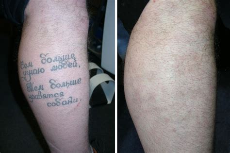 Возможные проблемы при использовании хны перед и после татуировки