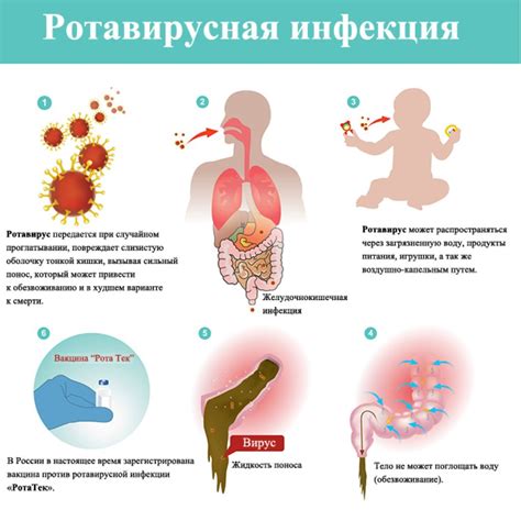 Диагностика ротовирусной инфекции без гипертермии