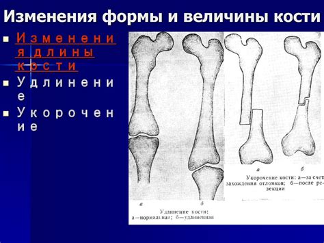 Изменения формы и размера костей