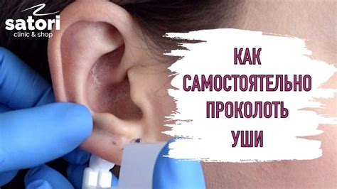 Как лечить перекос лица после прокола уха