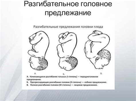 Как определить положение плода по его шевелениям