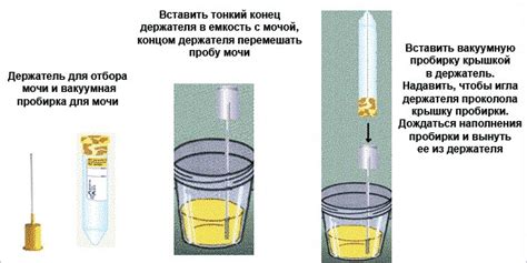 Как сдавать мочу при приеме Фурадонина