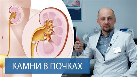 Как узнать, что у вас воспаление в почках