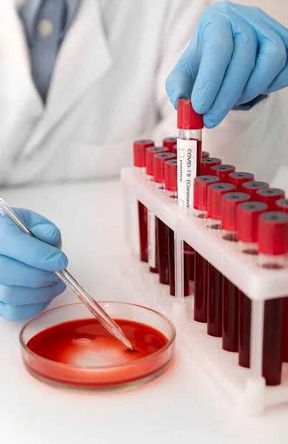 Как узнать о низком гемоглобине без анализа крови: эффективные методы