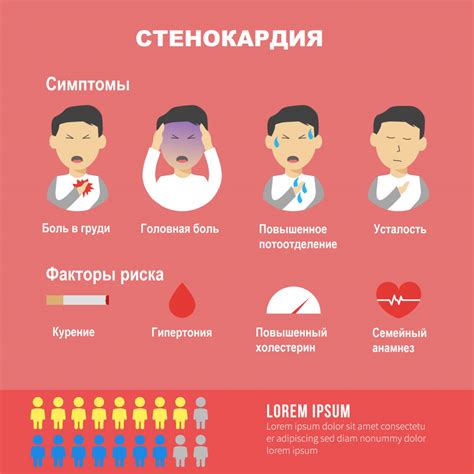 Ключевые моменты использования бани при стенокардии напряжения
