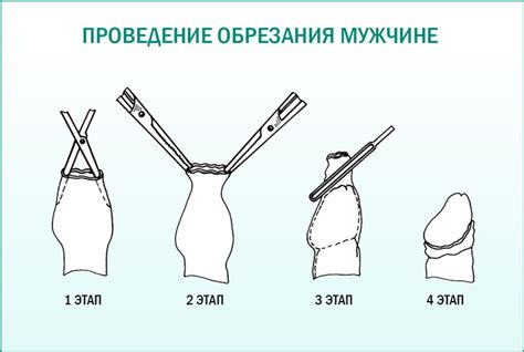 Крайняя плоть: восстановление после обрезания
