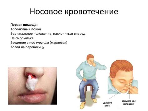 Кровь из носа от холода: причины и методы предотвращения