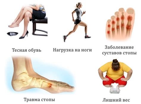 Легкий спорт для гигромы на ноге