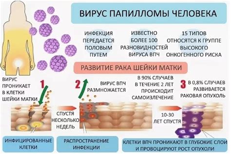 Лечение ВПЧ 6 и 11