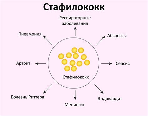 Методы лечения прыщей, вызванных стафилококком