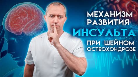 Механизм развития хондроза