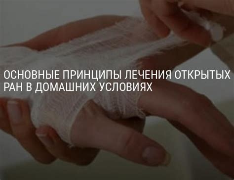 Мифы о мочении открытых ран