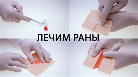 Мощное средство в реабилитации раны
