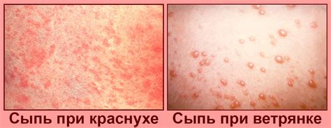 Негативные воздействия окружающей среды и сыпь на коже
