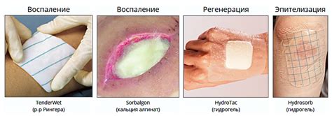 Ожоги и открытые раны: как правильно ухаживать