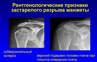 Основные методы лечения разрыва связок