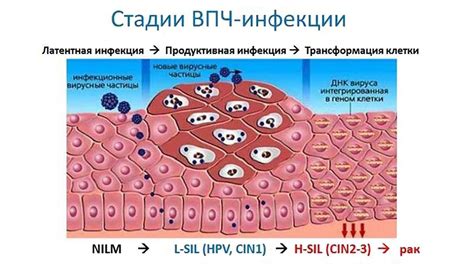 Основные симптомы ВПЧ 6 и 11
