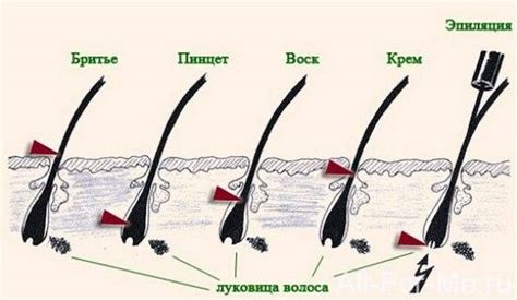 Отсутствие роста волос на ногах: возможные причины и их решение