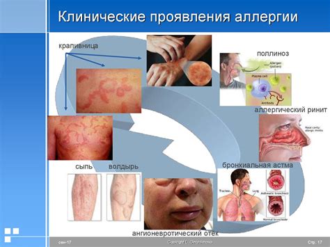 Первые проявления аллергии на хурму