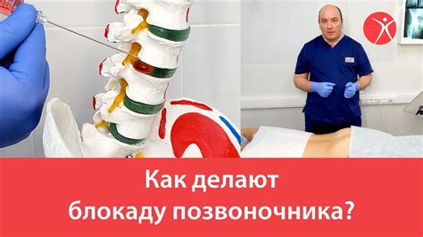 Положительный эффект массажа после блокады позвоночника