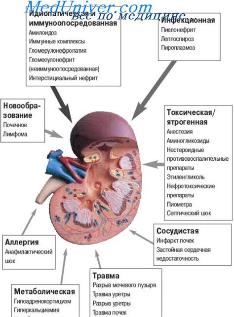 Польза имбиря при почечной недостаточности: что говорят исследования