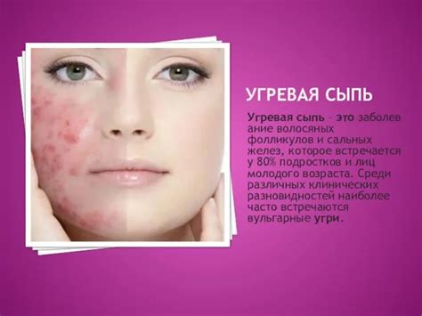 Пользование некачественной косметикой и угревая сыпь