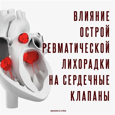 Последствия неправильного разделения капсулы
