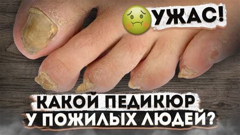 Почему важно заботиться о ногах при старении: