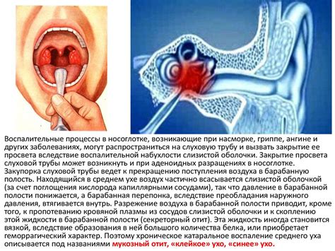Предотвращение повреждения слуха