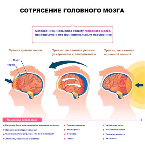 Признаки прихода в голову только хорошее
