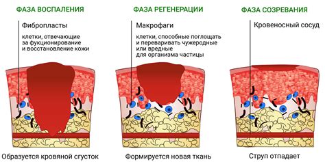 Причины возникновения ожога от утюга