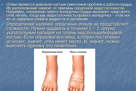 Причины и симптомы отеков